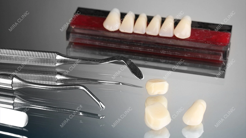 Composite Crowns